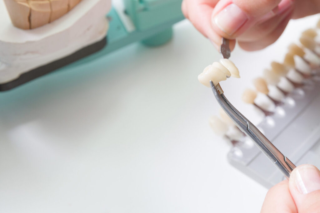dental implants are color checked in a dental laboratory