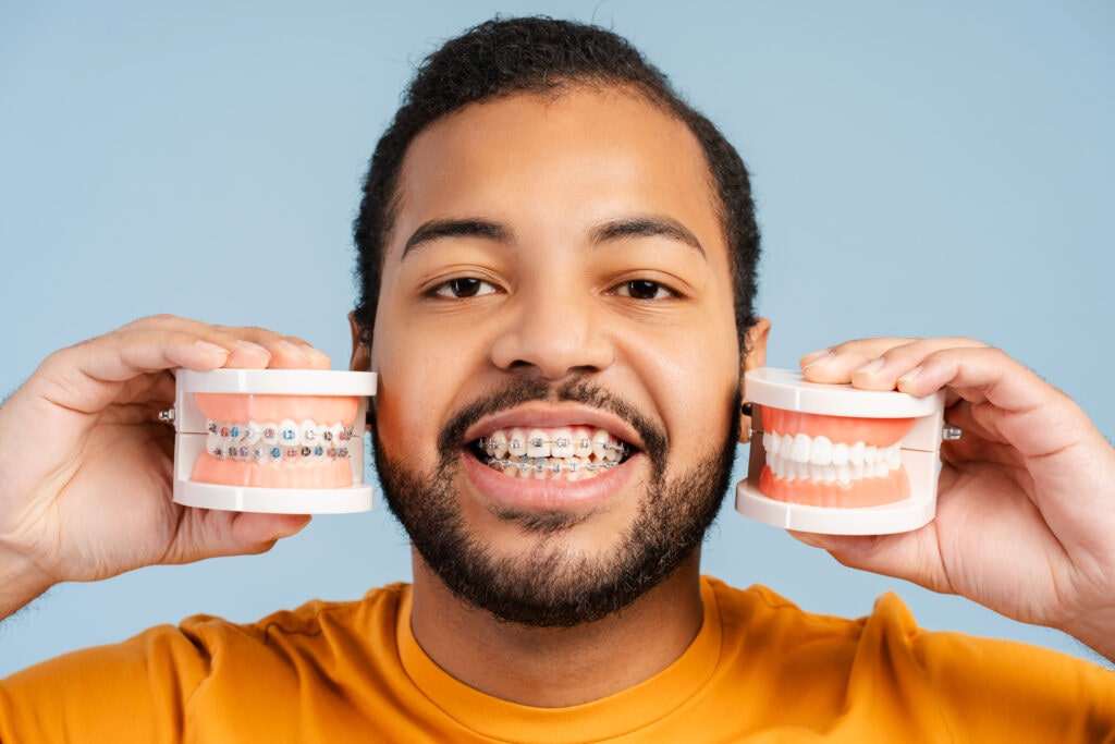 smiling man with orthodontic braces, holding plastic jaw models